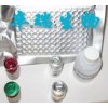 幽门螺旋杆菌尿素酶抗体检测试剂盒（胶体金法）